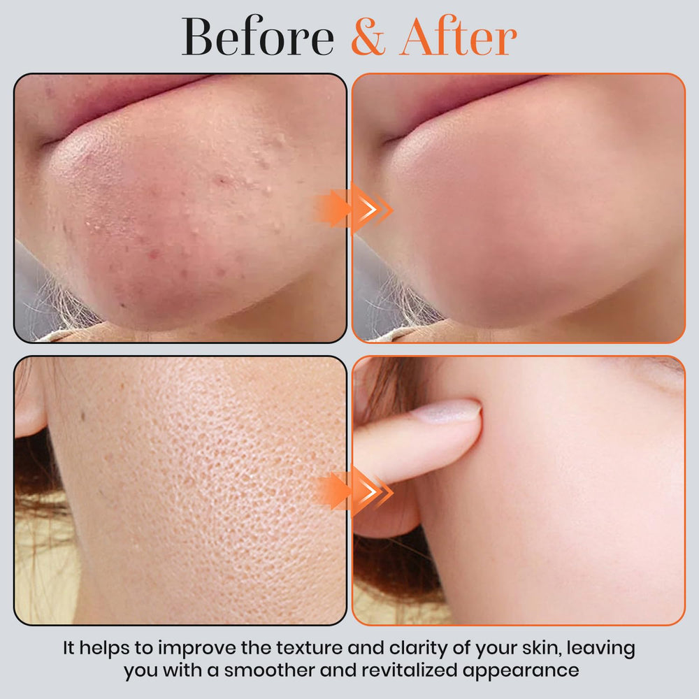 T.Chilyn application on face demonstration illustrating gentle exfoliation