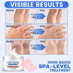 TEAWOO application on heel showing targeted treatment for cracked skin