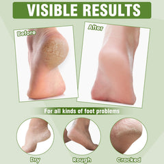 TEAWOO foot mask in use on feet offering quick hydration convenience