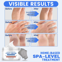 TEAWOO gel heel socks packaging and pair showing reusable design for intensified moisturization