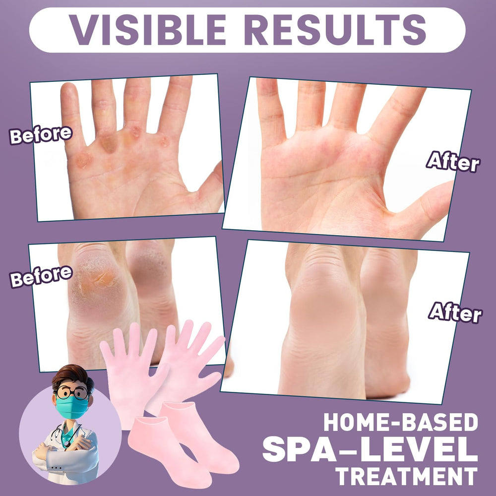 TEAWOO silicone socks worn on feet while relaxing, enabling hands-free moisturizing