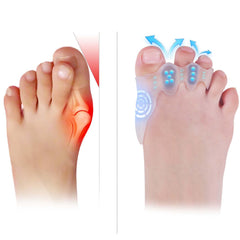 Tevezo front packaging showing small toe spacers and 20 fillers, clear product benefits