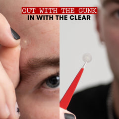 THAYERS patch on skin demonstrating adhesion and immediate protective barrier benefit