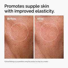 The Ordinary serum texture on dropper highlighting rapid absorption and lightweight hydration benefit