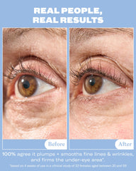 Then I Met You ceramic applicator close-up for cooling, mess-free eye application benefit