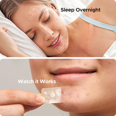 TKTK patch applied on chin protecting and flattening blemish