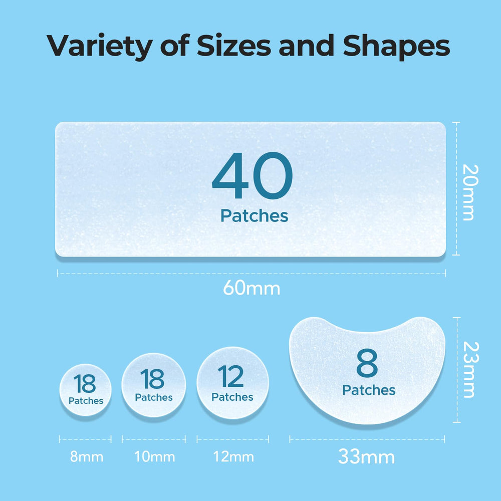 TKTK comparison of 8mm, 10mm, 12mm dots illustrating size options