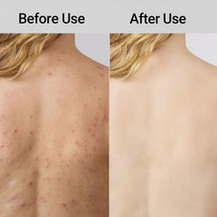 TLOPA Blissal two sides comparison showing soft and firm textures for tailored care