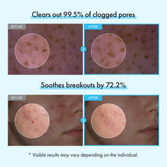 TOSOWOONG capsule close-up revealing micro capsules that absorb sebum