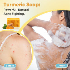 Treeroot soap in use washing face to show gentle daily cleansing benefit