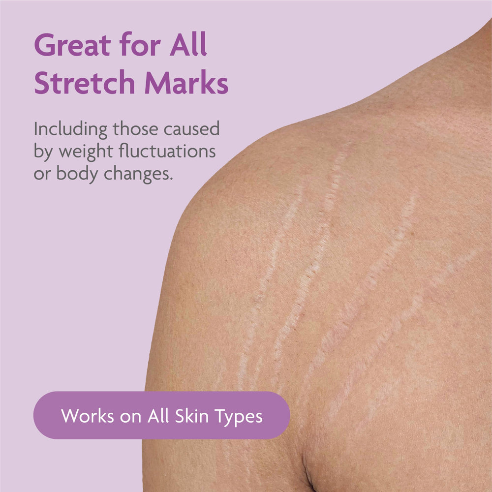 TriLASTIN cream spread on skin demonstrating smooth hydration