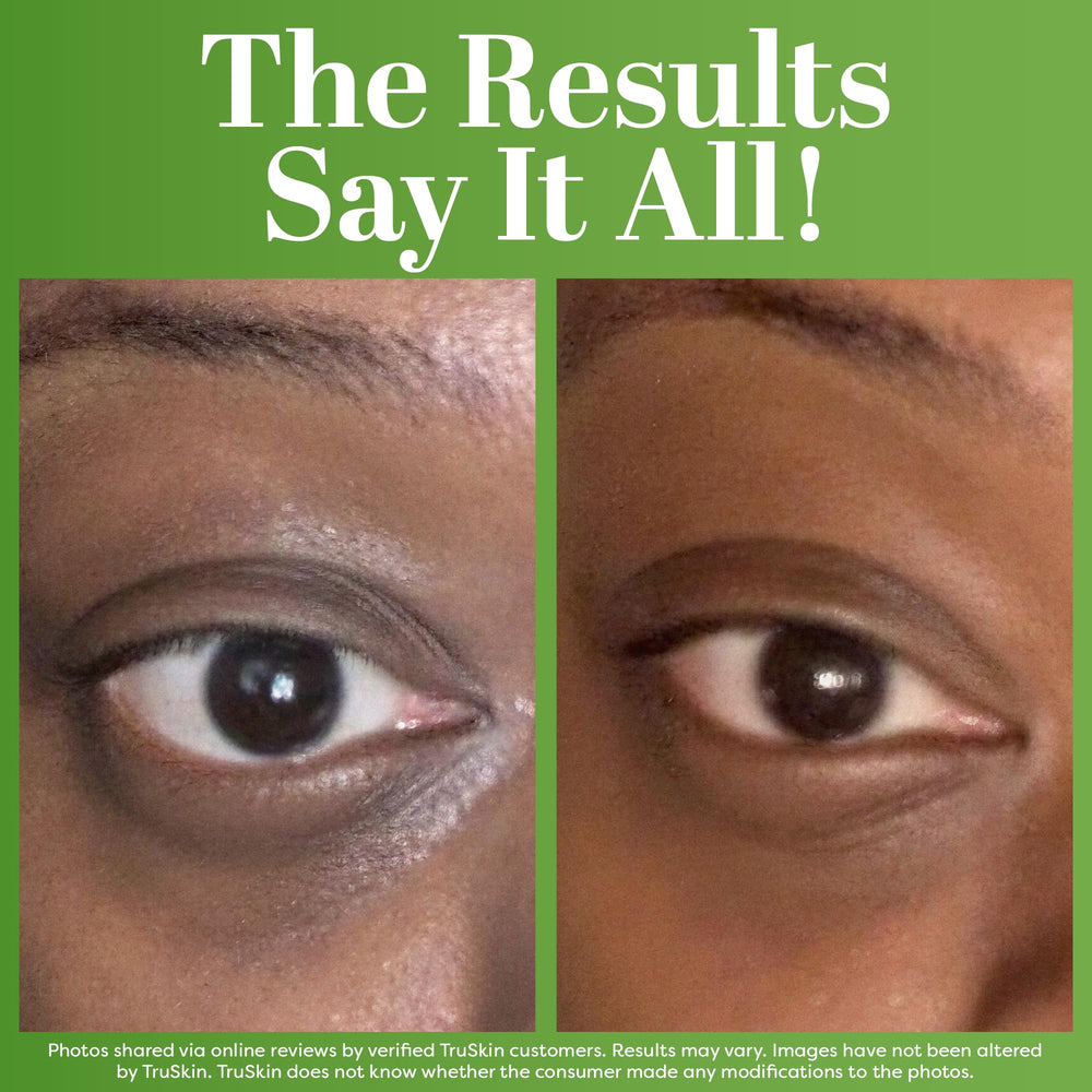 TruSkin applied under eye demonstrating smooth, cooling finish