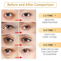 Tunbot before and after comparison showing reduced puffiness and smoother under-eye