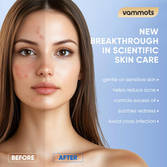 vammots towel removing makeup from face, effective and lint-free result
