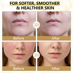Veakoo being applied to cheek demonstrating gentle hydration benefit