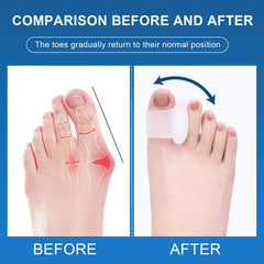 Viexpand gel spacer inside athletic shoe reducing friction during activity