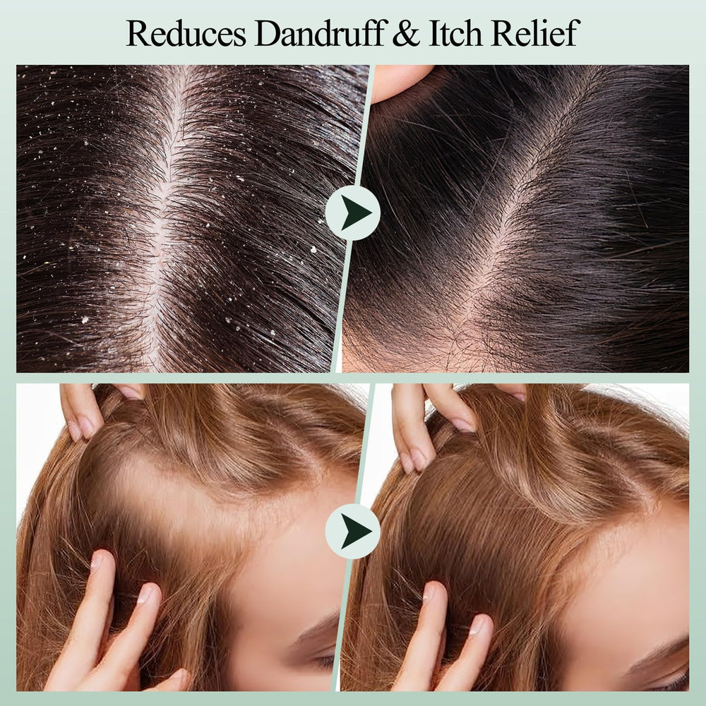 VOERUY being applied to wet hair roots demonstrating simple at-home use