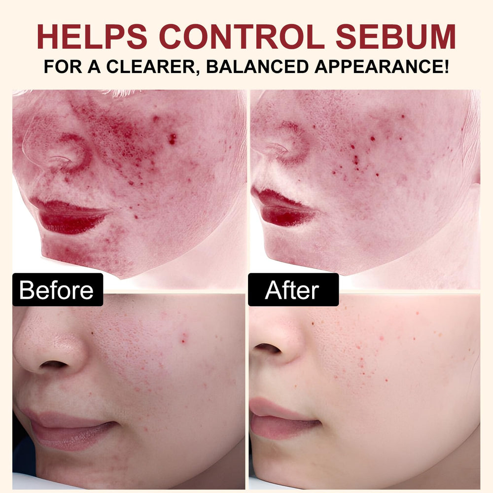 VOFANK applying ampoule to cheek to reduce blackheads and refine pores