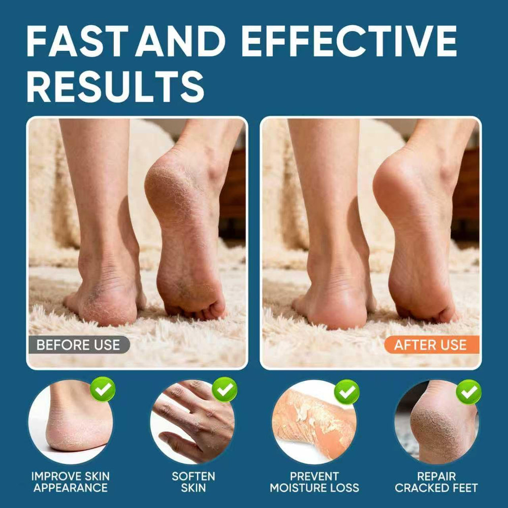VREKEF being applied to heel to soften calluses and improve comfort
