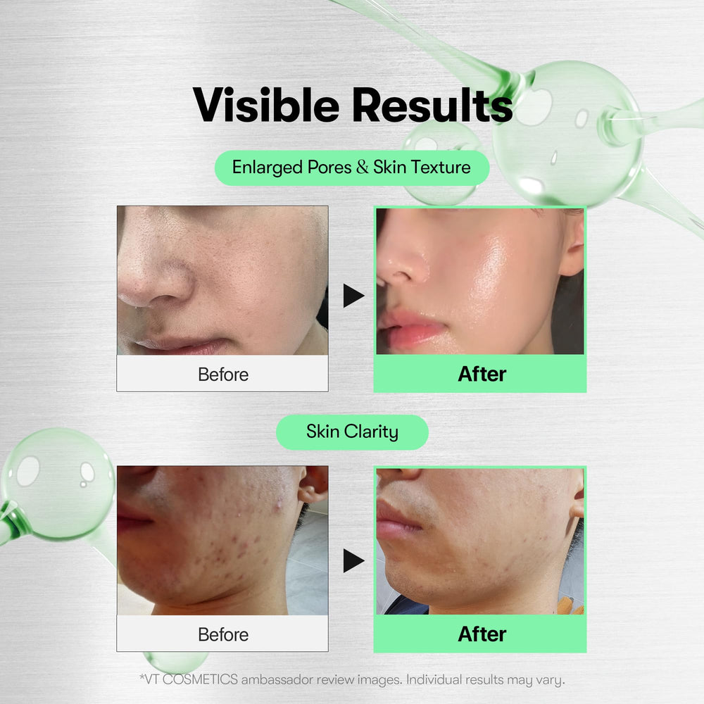 VT COSMETICS close-up of spicule texture showing mild exfoliation benefit