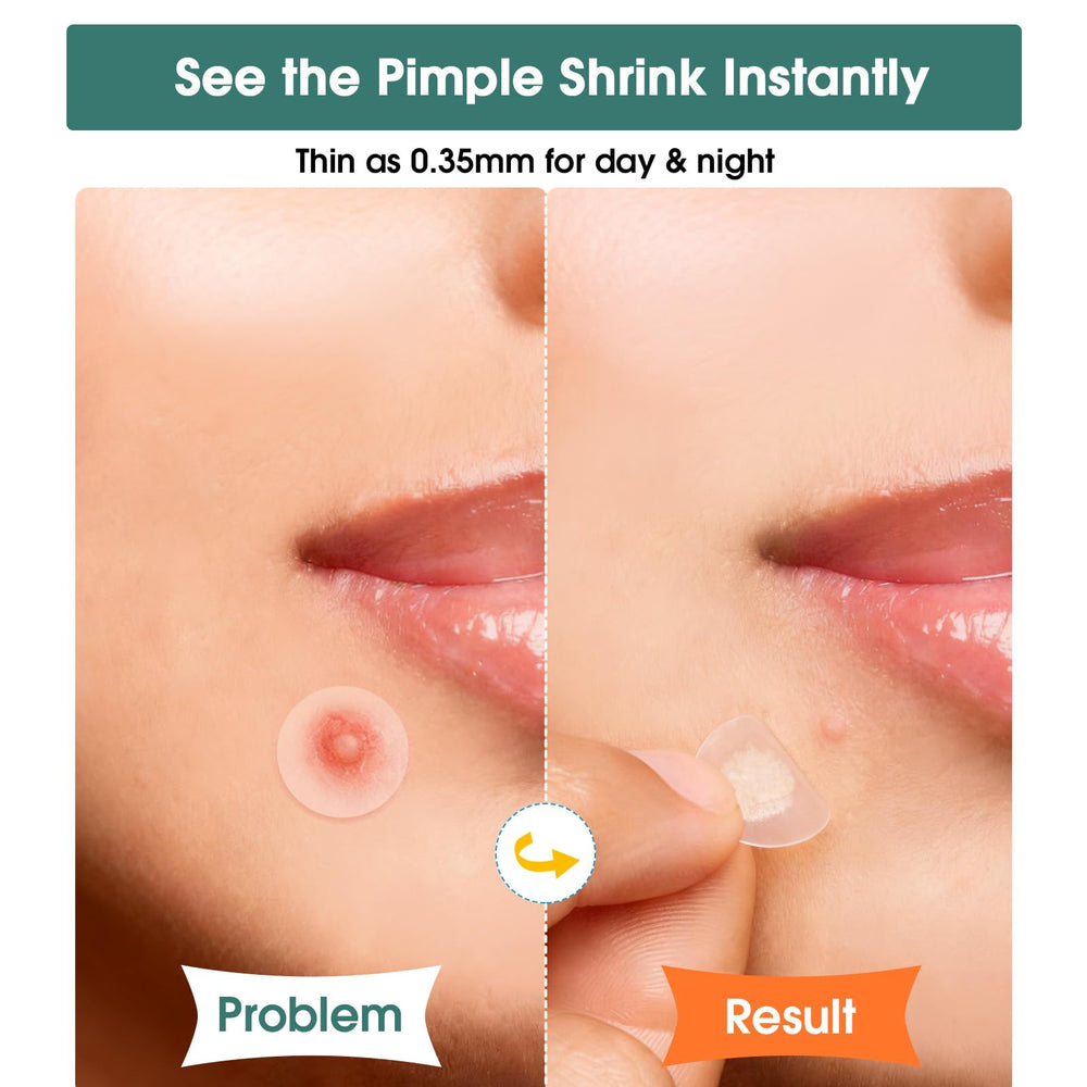 WakeALL contour patch applied to nose offering discreet coverage
