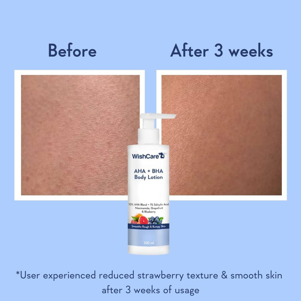 WishCare lotion texture on hand demonstrating lightweight absorbent formula and hydration