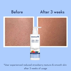 WishCare lotion texture on hand demonstrating lightweight absorbent formula and hydration