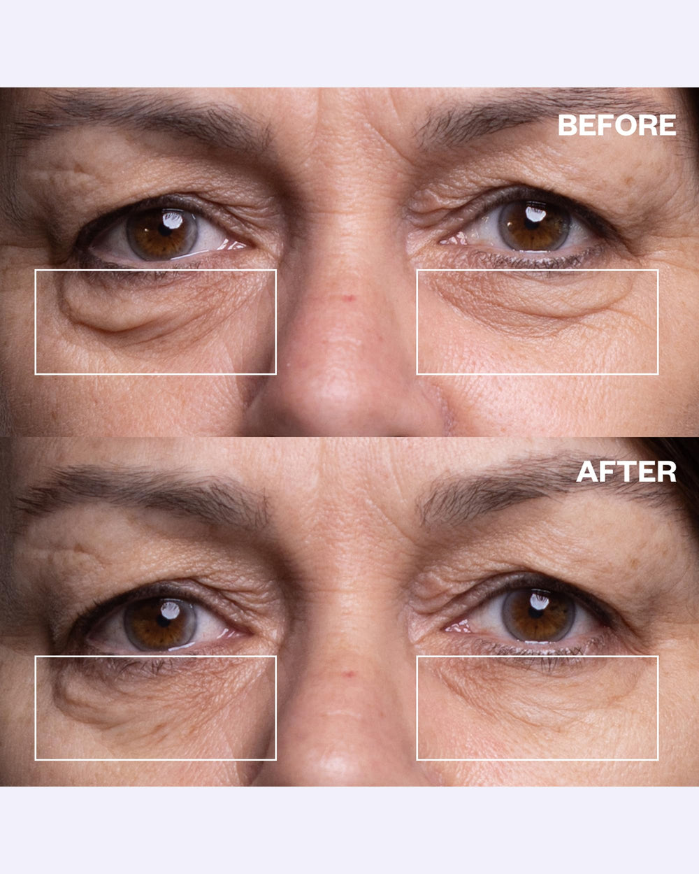Wrinkles Schminkles being applied under eye demonstrating comfortable overnight wear