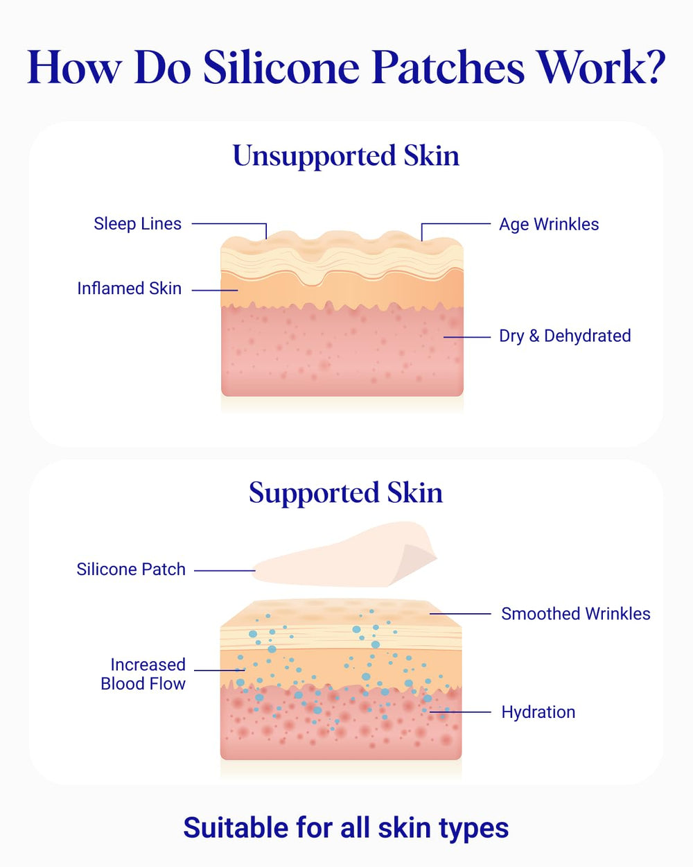 Wrinkles Schminkles storage sheet with patches to preserve adhesive and reuse