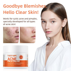 YAFUSIPE applying cream to back acne area for targeted control
