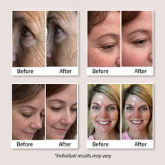 YEOUTH applying under-eye to reduce visible puffiness