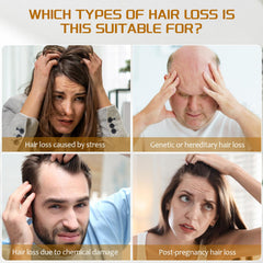 YOUNGYOUNGLOVE ingredient label highlighting minoxidil and biotin for strengthened strands