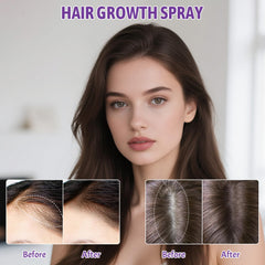 YOUNGYOUNGLOVE scalp application on man illustrating targeted treatment for thinning areas and fuller look