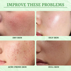 YTRAJU ingredients label listing salicylic acid and centella asiatica