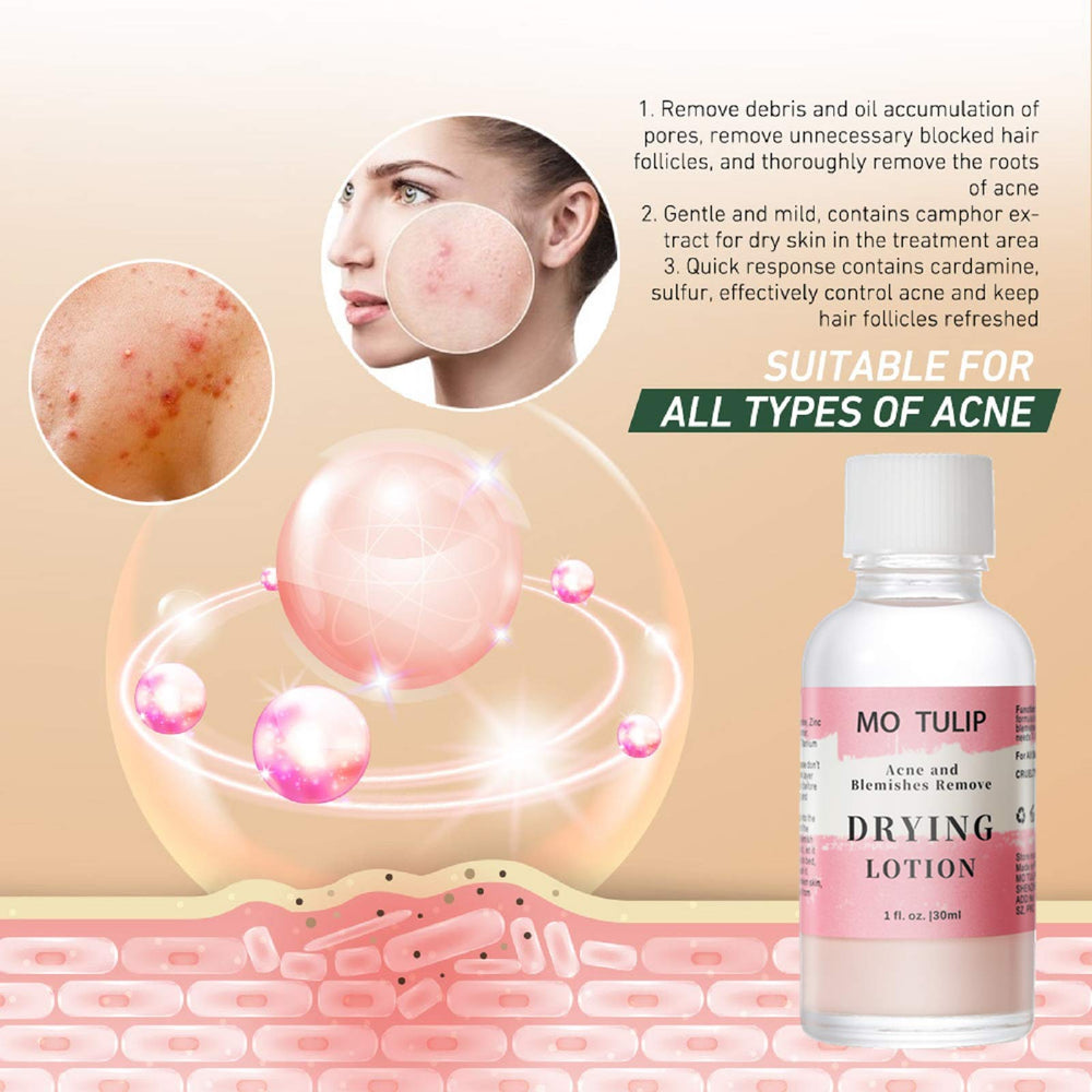 YUZAMOOR MO TULIP before and after scale showing reduced pimple size and clearer skin