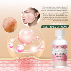 YUZAMOOR MO TULIP before and after scale showing reduced pimple size and clearer skin