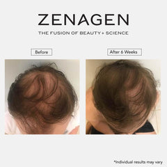 Zenagen Revolve on bathroom shelf in lifestyle scene for everyday grooming benefit