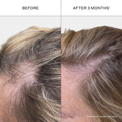 Zenagen shampoo foam texture on palm showing gentle lather and easy spread