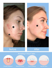 ZHAOLIESM lifestyle scene sleeping with patch for overnight protection
