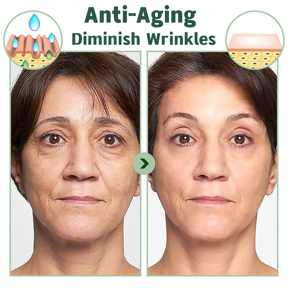 zhnnt mask applied on a model demonstrating comfortable overnight wear