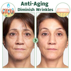 zhnnt mask applied on a model demonstrating comfortable overnight wear