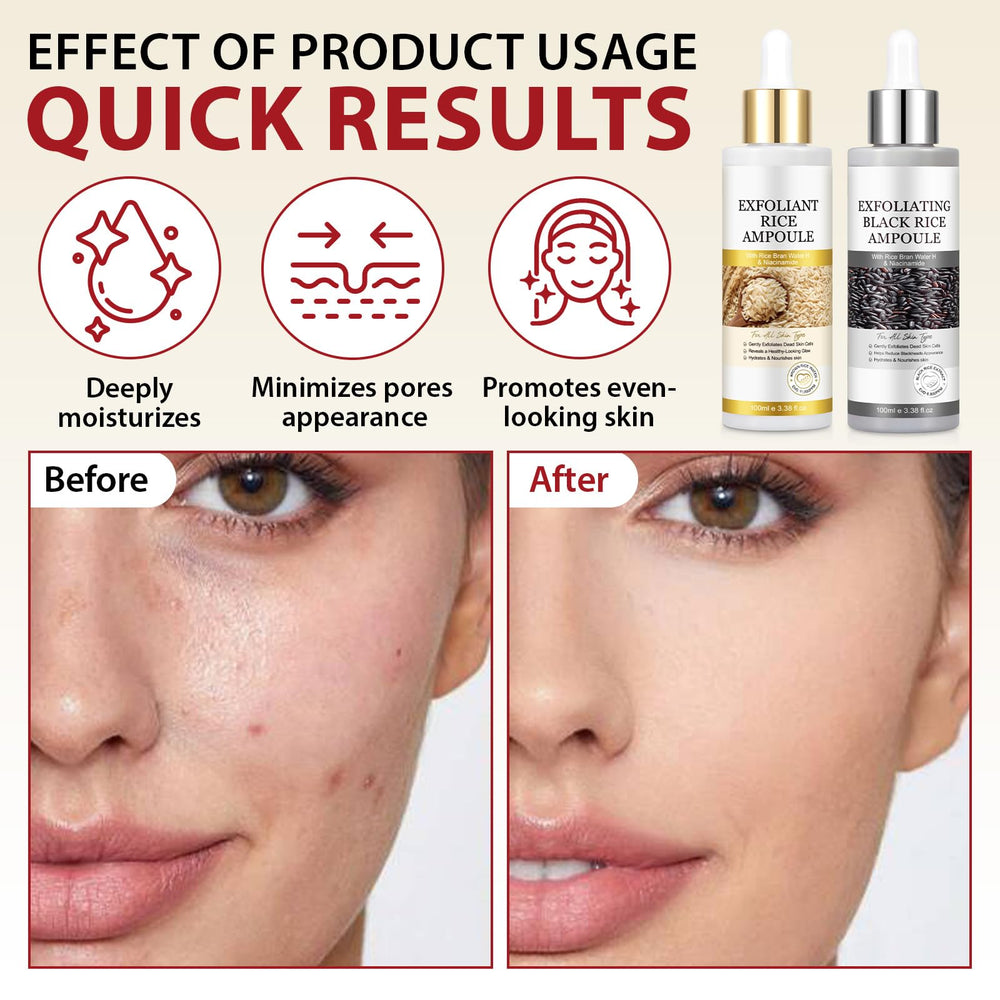 ZIXAOK black rice ampoule close-up texture for pore refining