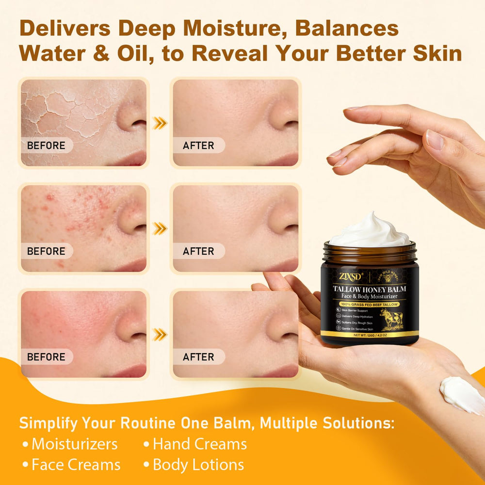 ZIXSD application with fingers on cheek, soothing moisturization benefit