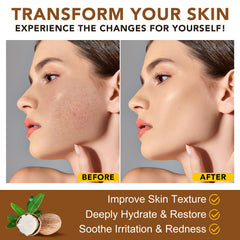 ZODENIS applying shea butter on hand for intense hydration benefit