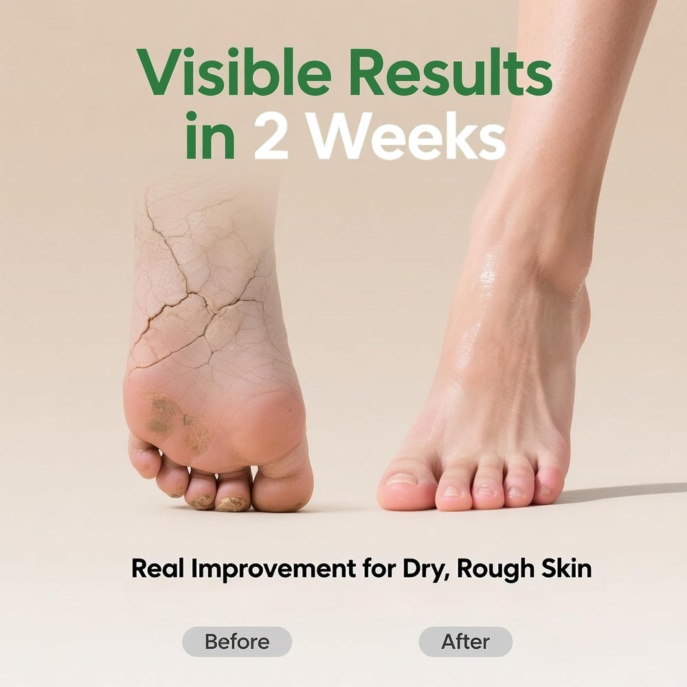 ZyraGloz applying cream to heels to soften and hydrate