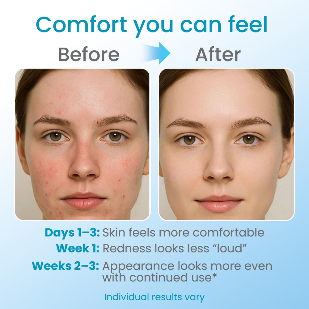 ZZILME applied to hand and wrist to hydrate thin sensitive skin