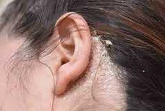 111MedCo applying bar to beard area to reduce visible flakes