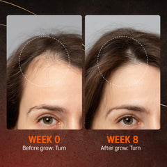 ABERA applying serum to scalp, promoting fuller-looking hair when used consistently