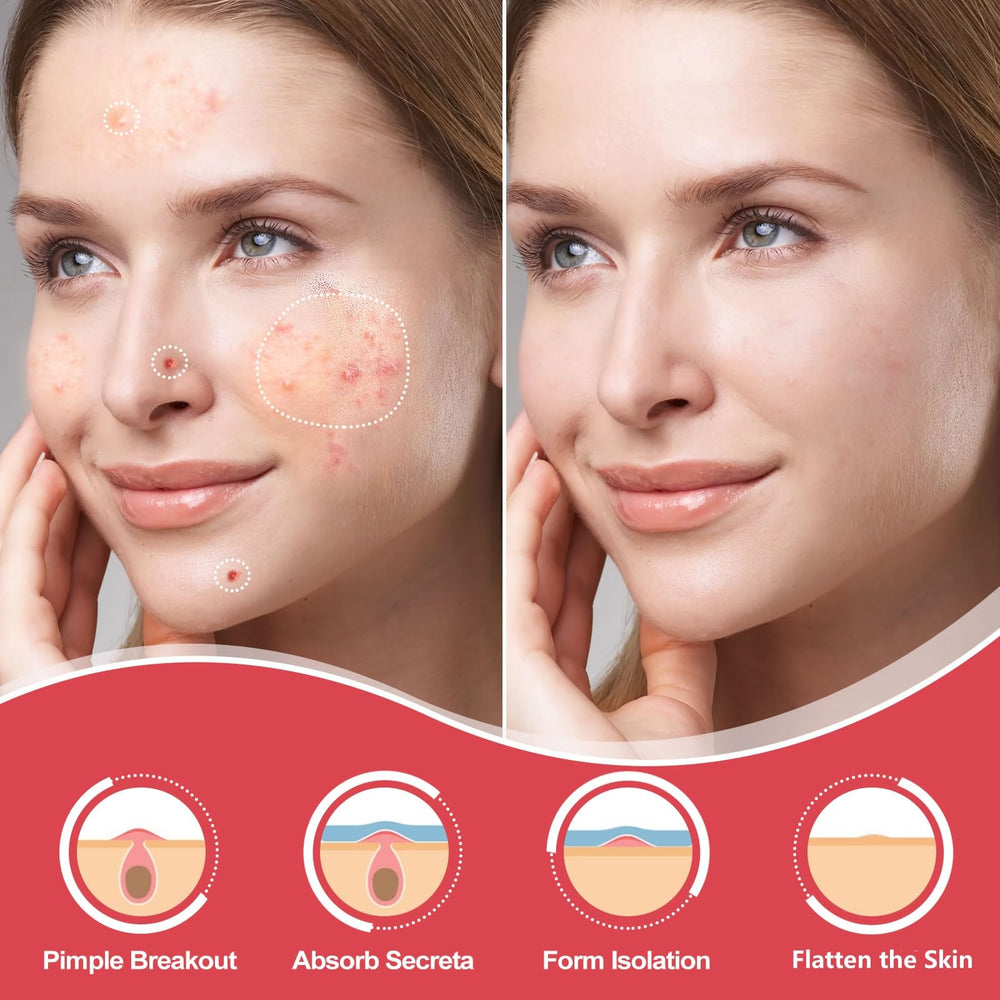 AcneGo close-up texture of thin hydrocolloid patch for discreet wear