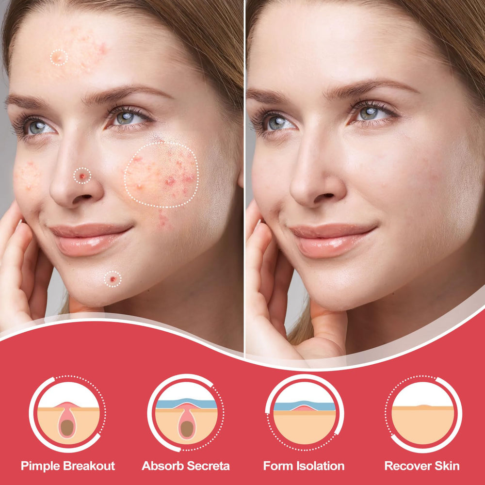 AcneGo close-up texture of hydrocolloid patch highlighting smooth finish